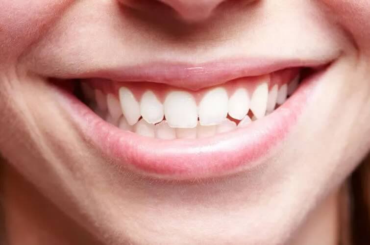 8 Pasta Gigi Untuk Menghilangkan Karang Gigi