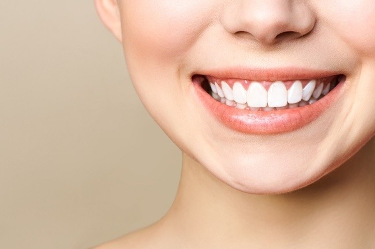 Cara Membersihkan Karang Gigi Yang Sudah Mengeras Secara Alami