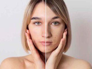 6 Rekomedasi Skincare Untuk Wajah Belang